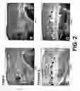 Fig. 03 - Methods and compositions for the promotion of a hair growth utilizing actin binding peptides