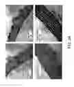 Fig. 05 - Methods for treating and preventing hypertension and hypertension-related disorders