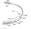 Fig. 01 - Subcutaneous electrode with improved contact shape for transthorasic conduction