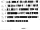 Fig. 09 - Frog prince, a transposon vector for gene transfer in vertebrates