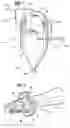 Fig. 02 - Flotation device and method of froth flotation