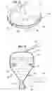Fig. 07 - Flotation device and method of froth flotation