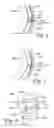 Fig. 03 - Automatically disengaging spacing mechanism for a mechanical seal