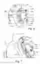 Fig. 05 - Automatically disengaging spacing mechanism for a mechanical seal