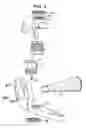 Fig. 03 - Adjustable boss for steering knuckle and method of installing same