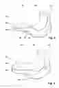 Fig. 03 - Rigid axle for a vehicle, comprising integrated trailing arms and mounting brackets