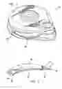 Fig. 02 - Connector for catheter attachment to an implantable pump