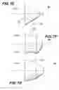 Fig. 13 - Pipe coupling having keys with camming surfaces