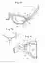 Fig. 08 - Temple connection structure of spectacles frame