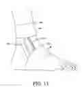 Fig. 12 - Adjustable orthotic brace