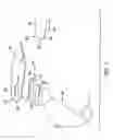 Fig. 02 - Surgical knife blade attachment and method for using same
