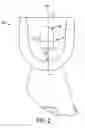 Fig. 03 - Surgical knife blade attachment and method for using same