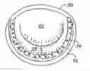 Fig. 01 - Annuloplasty ring for mitral valve prolapse