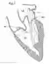 Fig. 02 - Annuloplasty ring for mitral valve prolapse