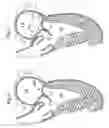 Fig. 06 - Annuloplasty ring for mitral valve prolapse