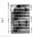 Fig. 04 - Transgenic aves producing human polyclonal antibodies