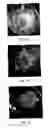 Fig. 02 - Selection of fungal resistant grape somatic embryos