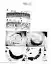 Fig. 13 - Root-specific expansin gene regulating root growth and obstacle-touching stress resistance in the plant