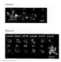 Fig. 03 - Gene participating in the synthesis of brassinosteroid