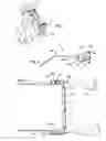 Fig. 02 - Clip-on light apparatus