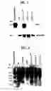 Fig. 02 - Diagnostic methods and gene therapy using reagents derived from the human metastasis suppressor gene KAI1