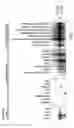 Fig. 02 - Fetal polypeptides from human liver