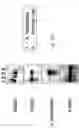 Fig. 11 - Fetal polypeptides from human liver