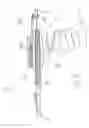 Fig. 04 - Implantable electrode, insertion tool for use therewith, and insertion method