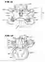 Fig. 06 - Facet arthroplasty devices and methods
