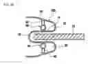 Fig. 09 - Device for and method of preventing rattling of door window glass for vehicles
