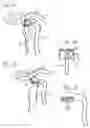 Fig. 02 - Grip