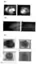 Fig. 02 - Generation of neural stem cells from undifferentiated human embryonic stem cells
