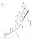 Fig. 03 - Systems and methods employing a push tube for delivering a urethral sling