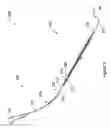 Fig. 04 - Systems and methods employing a push tube for delivering a urethral sling