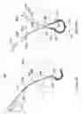 Fig. 06 - Systems and methods employing a push tube for delivering a urethral sling