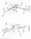 Fig. 13 - Systems and methods employing a push tube for delivering a urethral sling