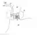 Fig. 01 - Electroactive polymer based artificial sphincters and artificial muscle patches