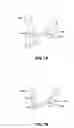 Fig. 09 - Electroactive polymer based artificial sphincters and artificial muscle patches