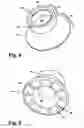 Fig. 05 - Force isolating applicance
