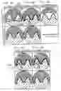 Fig. 05 - Gear and method and device for manufacturing the gear