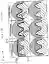 Fig. 11 - Gear and method and device for manufacturing the gear