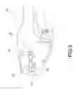 Fig. 04 - Rotational crimp die