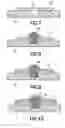 Fig. 04 - Method of creating gold contacts directly on printed circuit boards and product thereof