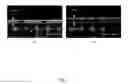 Fig. 04 - Imprinting of supported and free-standing 3-D micro- or nano-structures