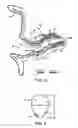 Fig. 02 - Precision micro-hole for extended life batteries