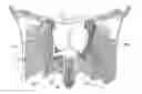 Fig. 01 - Method for treating sleep apnea and snoring