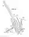 Fig. 06 - Turnbuckle head assembly