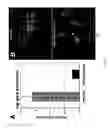 Fig. 09 - PDX1 expressing endoderm