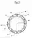 Fig. 03 - Endoscopic instrument