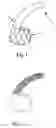 Fig. 02 - Embolic protection device for the prevention of stroke